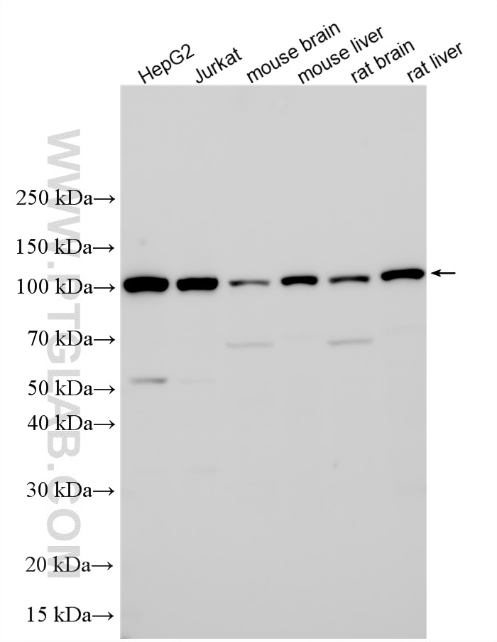 Western Blot (WB) analysis of various lysates using AlaRS Polyclonal antibody (17394-1-AP)