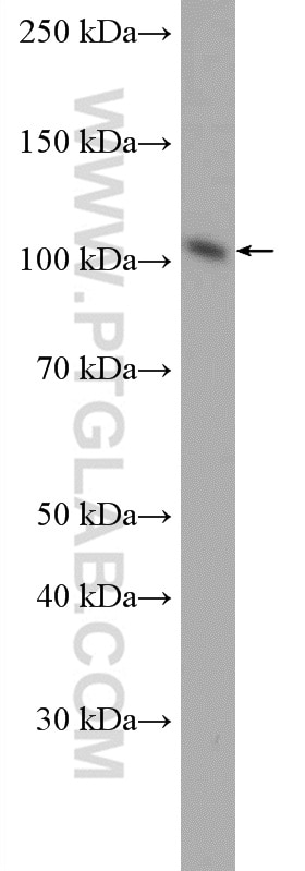 Western Blot (WB) analysis of Jurkat cells using AlaRS Polyclonal antibody (17394-1-AP)