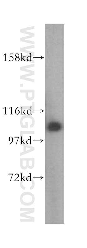 Western Blot (WB) analysis of HepG2 cells using AlaRS Polyclonal antibody (17394-1-AP)