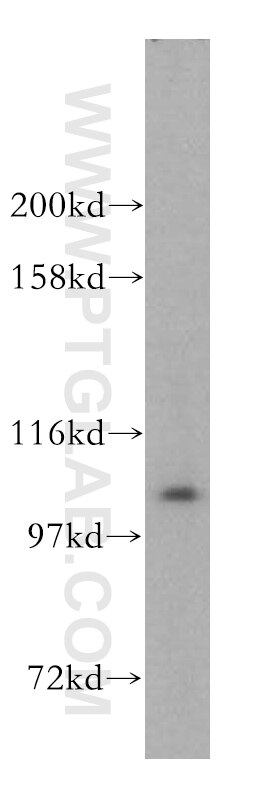 Western Blot (WB) analysis of HeLa cells using AlaRS Polyclonal antibody (17394-1-AP)