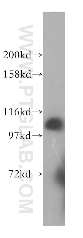 Western Blot (WB) analysis of Jurkat cells using AlaRS Polyclonal antibody (17394-1-AP)