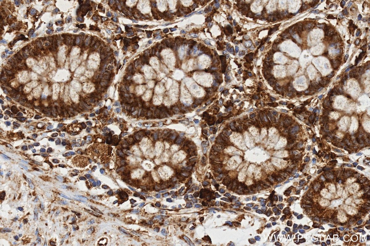 Function Aars AARS antibody (87581-2-RR) | Proteintech