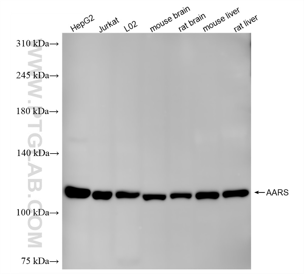 Aars Proofreading AARS antibody (87581-2-RR) | Proteintech