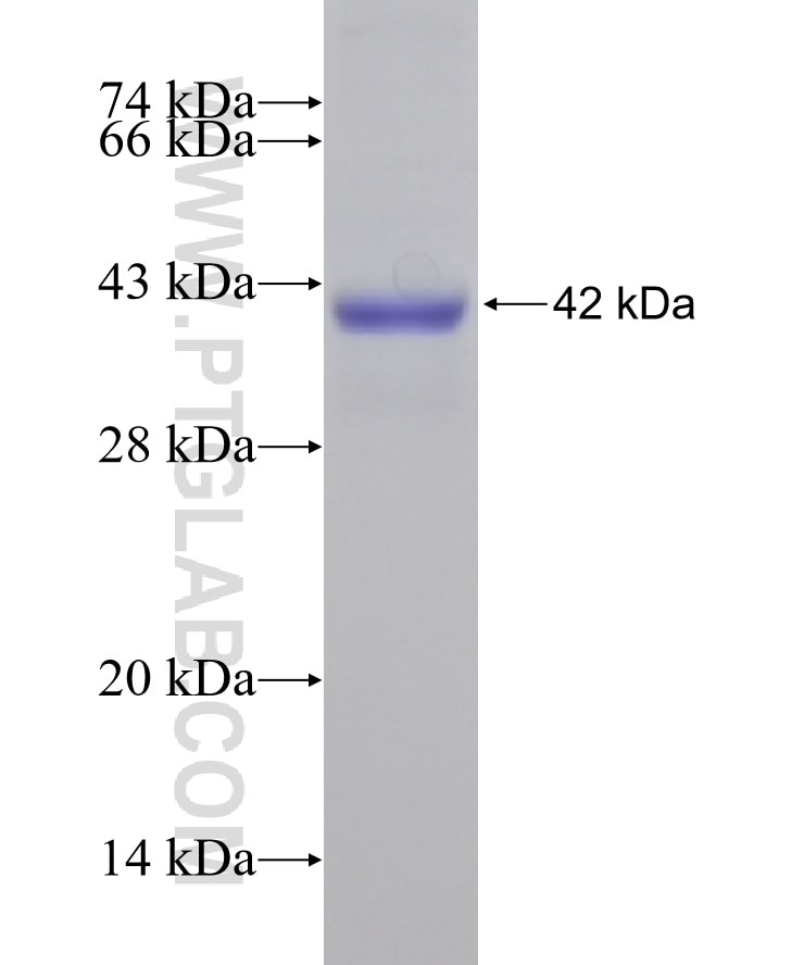 AARS fusion protein Ag11151 SDS-PAGE