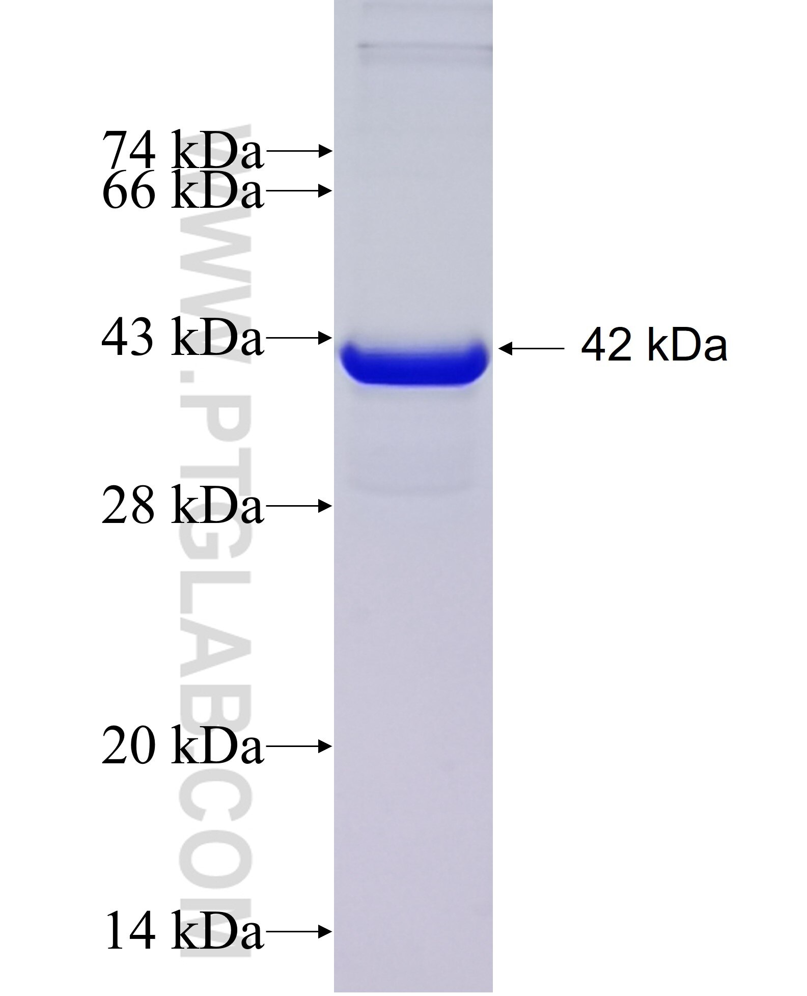 AARS fusion protein Ag11151 SDS-PAGE