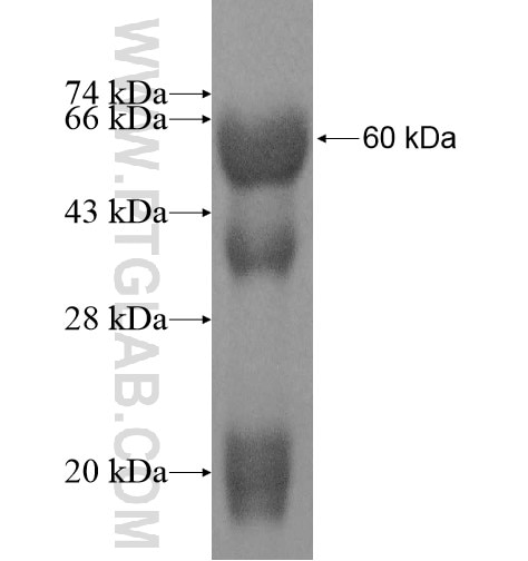 AARS fusion protein Ag11294 SDS-PAGE