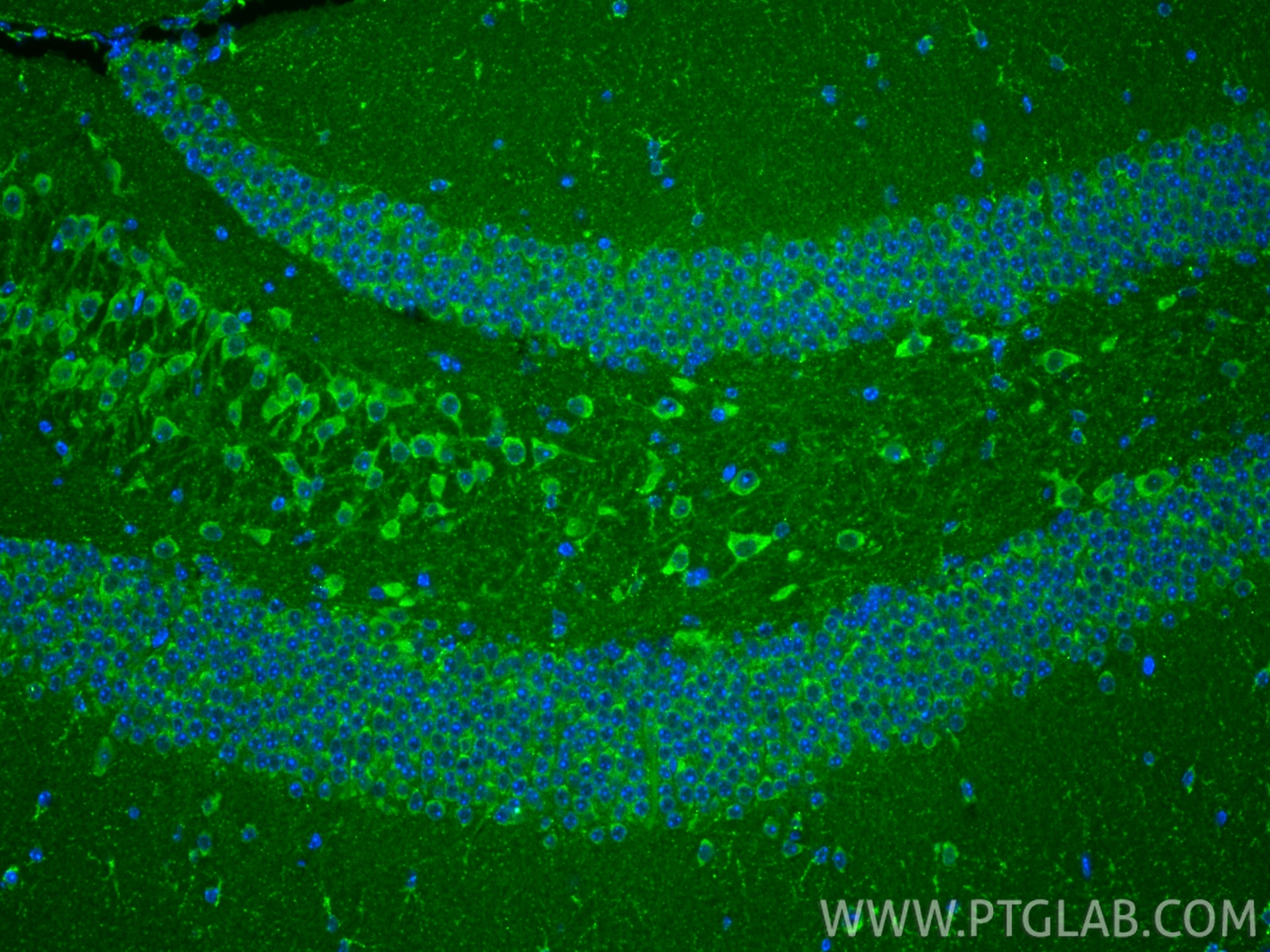 IF Staining of mouse brain using 22696-1-AP Immunofluorescence (IF) / fluorescent staining of mouse brain tissue using AARS2 Polyclonal antibody (22696-1-AP)