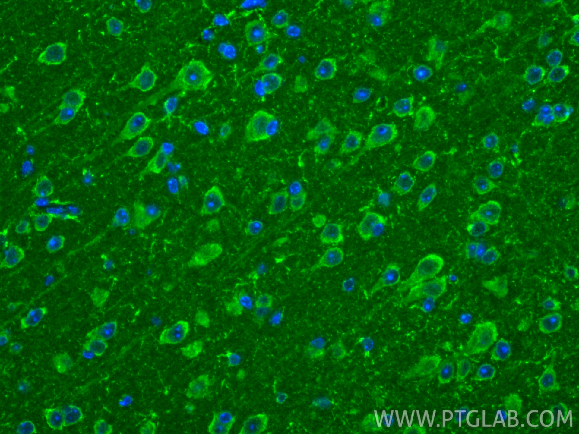 IF Staining of mouse brain using 22696-1-AP Immunofluorescence (IF) / fluorescent staining of mouse brain tissue using AARS2 Polyclonal antibody (22696-1-AP)