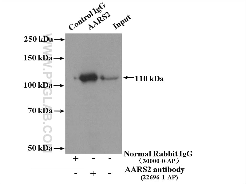Immunoprecipitation (IP) experiment of K-562 cells using AARS2 Polyclonal antibody (22696-1-AP)