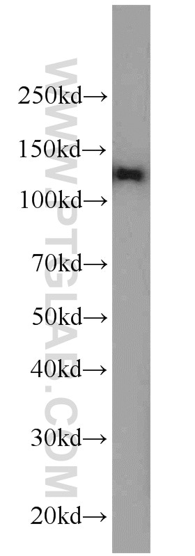 Western Blot (WB) analysis of K-562 cells using AARS2 Polyclonal antibody (22696-1-AP)