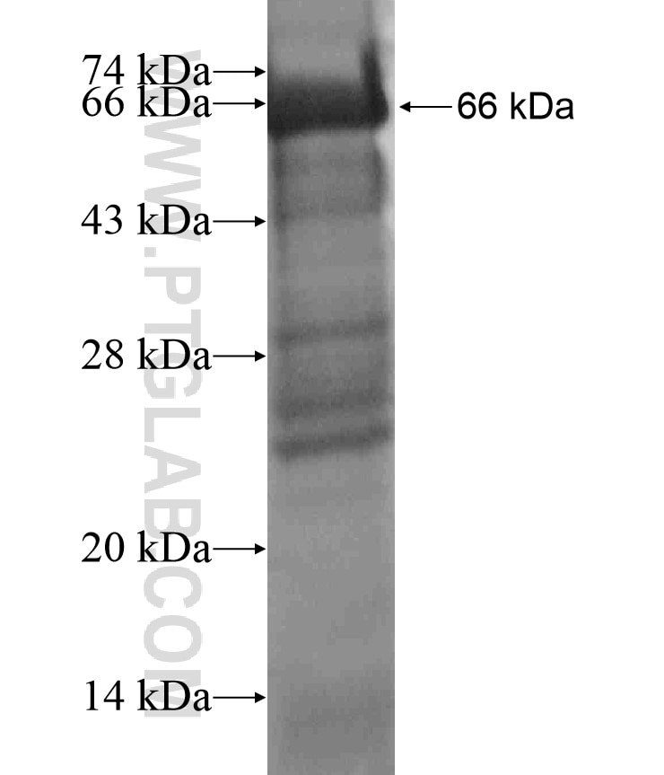 AARS2 fusion protein Ag18539 SDS-PAGE