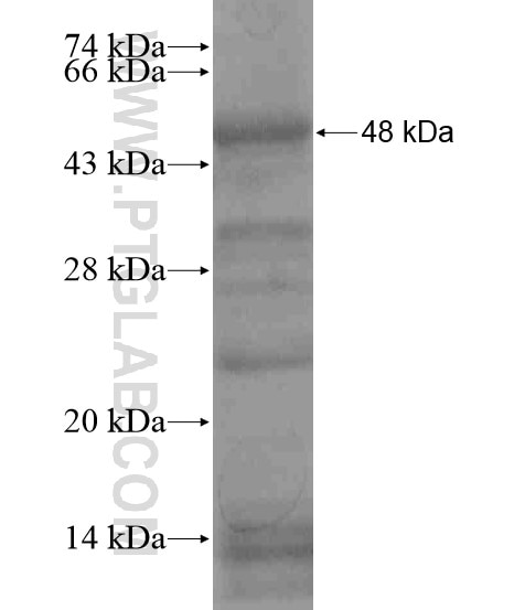 AARS2 fusion protein Ag18639 SDS-PAGE