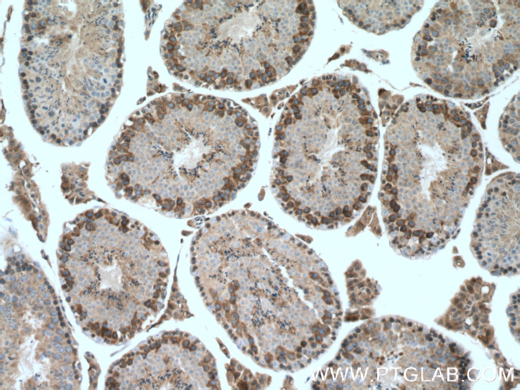 Immunohistochemistry (IHC) staining of mouse testis tissue using AARSD1 Polyclonal antibody (14900-1-AP)