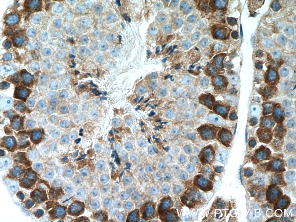 Immunohistochemistry (IHC) staining of mouse testis tissue using AARSD1 Polyclonal antibody (14900-1-AP)