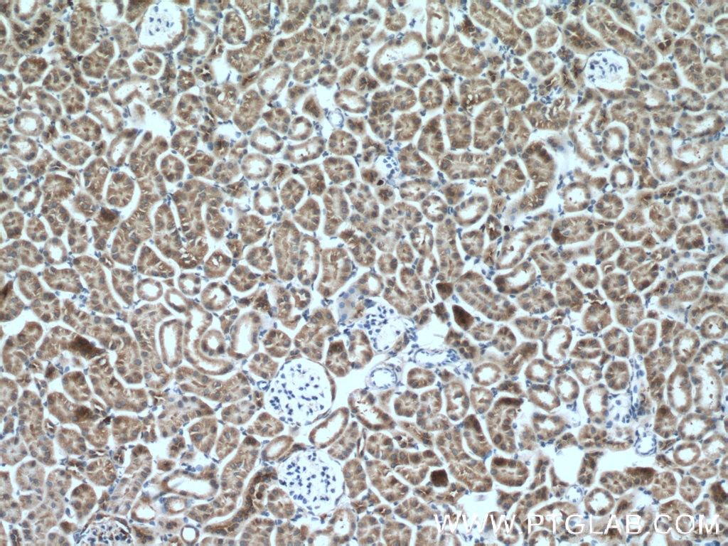 Immunohistochemistry (IHC) staining of mouse kidney tissue using AARSD1 Polyclonal antibody (14900-1-AP)
