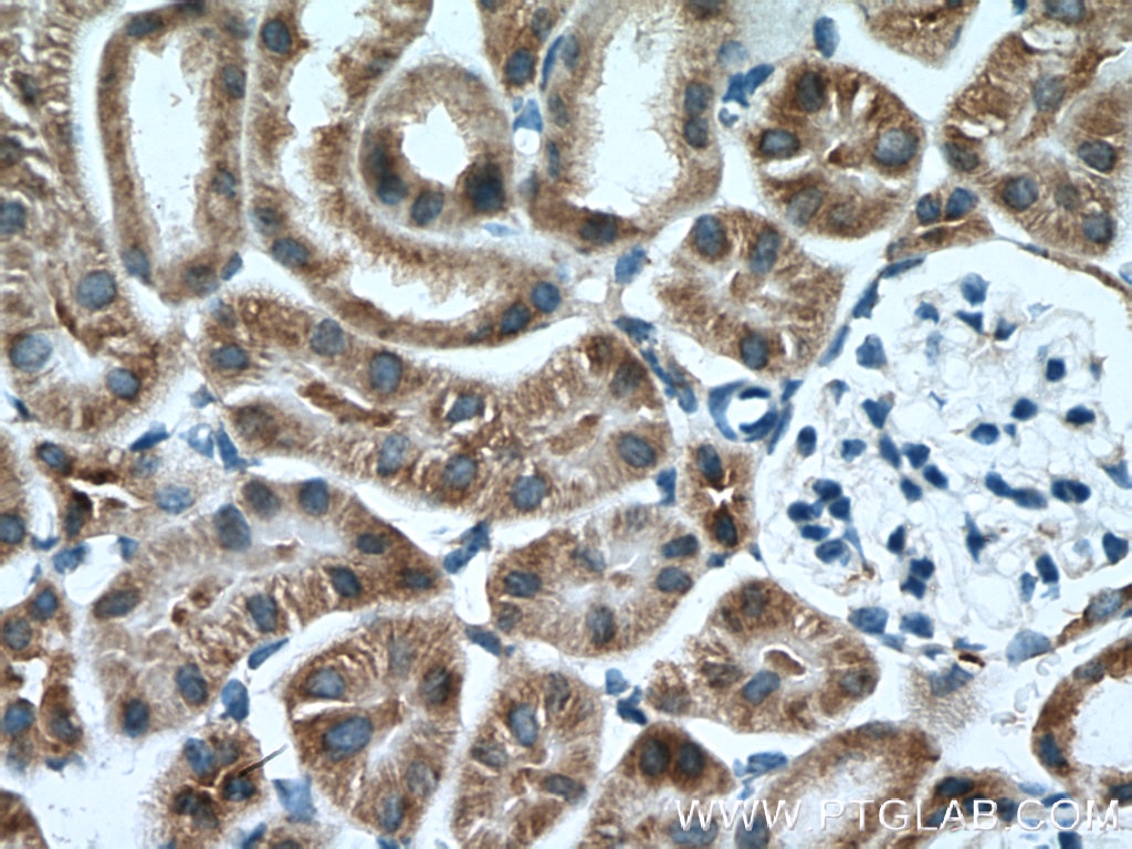 Immunohistochemistry (IHC) staining of mouse kidney tissue using AARSD1 Polyclonal antibody (14900-1-AP)