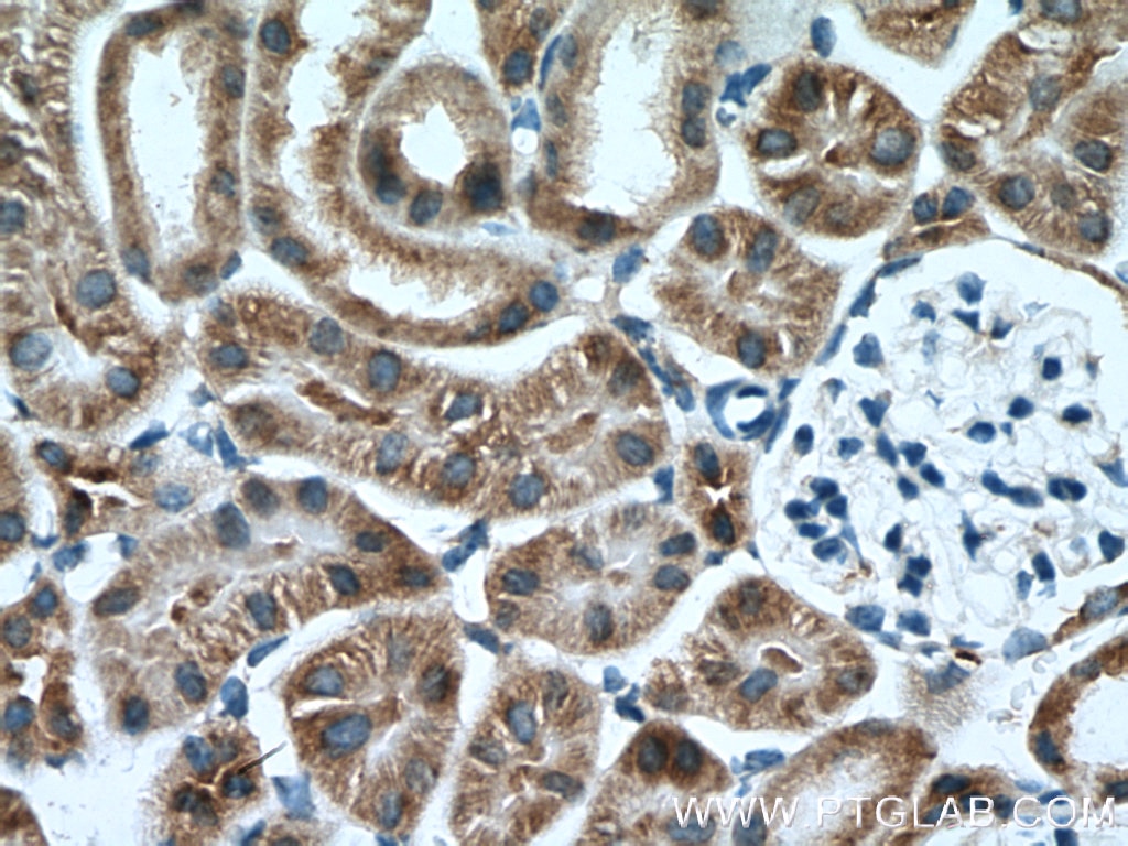 Immunohistochemistry (IHC) staining of mouse kidney tissue using AARSD1 Polyclonal antibody (14900-1-AP)