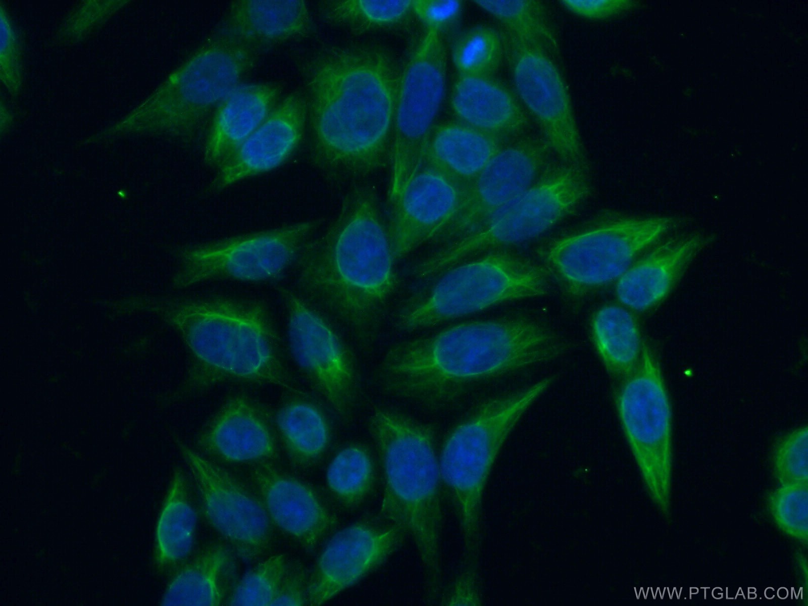 Immunofluorescence (IF) / fluorescent staining of HeLa cells using AASDHPPT Polyclonal antibody (11244-1-AP)