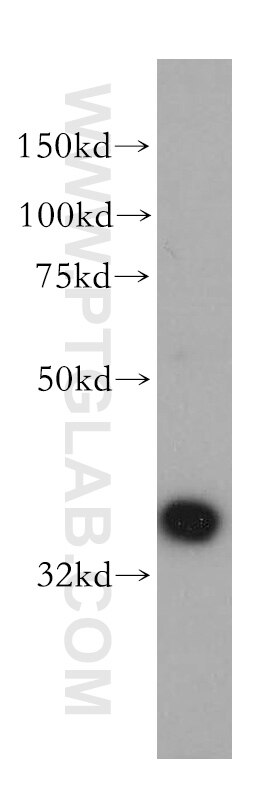 Western Blot (WB) analysis of human brain tissue using AASDHPPT Polyclonal antibody (11244-1-AP)