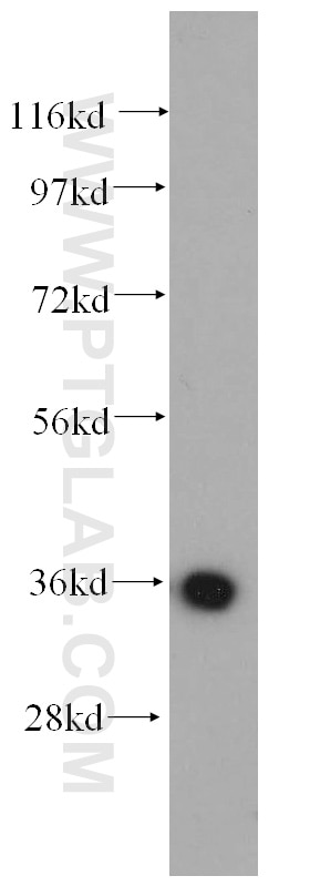 Western Blot (WB) analysis of human brain tissue using AASDHPPT Polyclonal antibody (11244-1-AP)