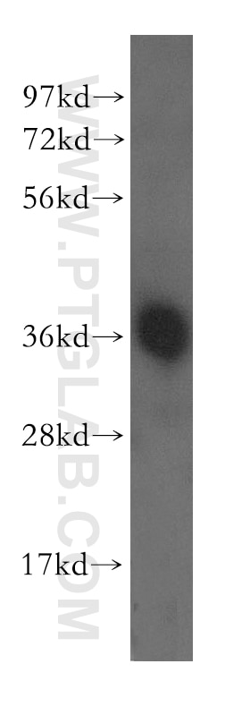Western Blot (WB) analysis of human brain tissue using AASDHPPT Polyclonal antibody (11244-1-AP)