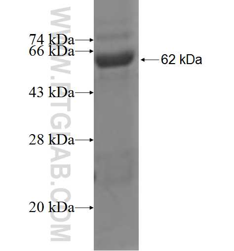 AASDHPPT fusion protein Ag1763 SDS-PAGE