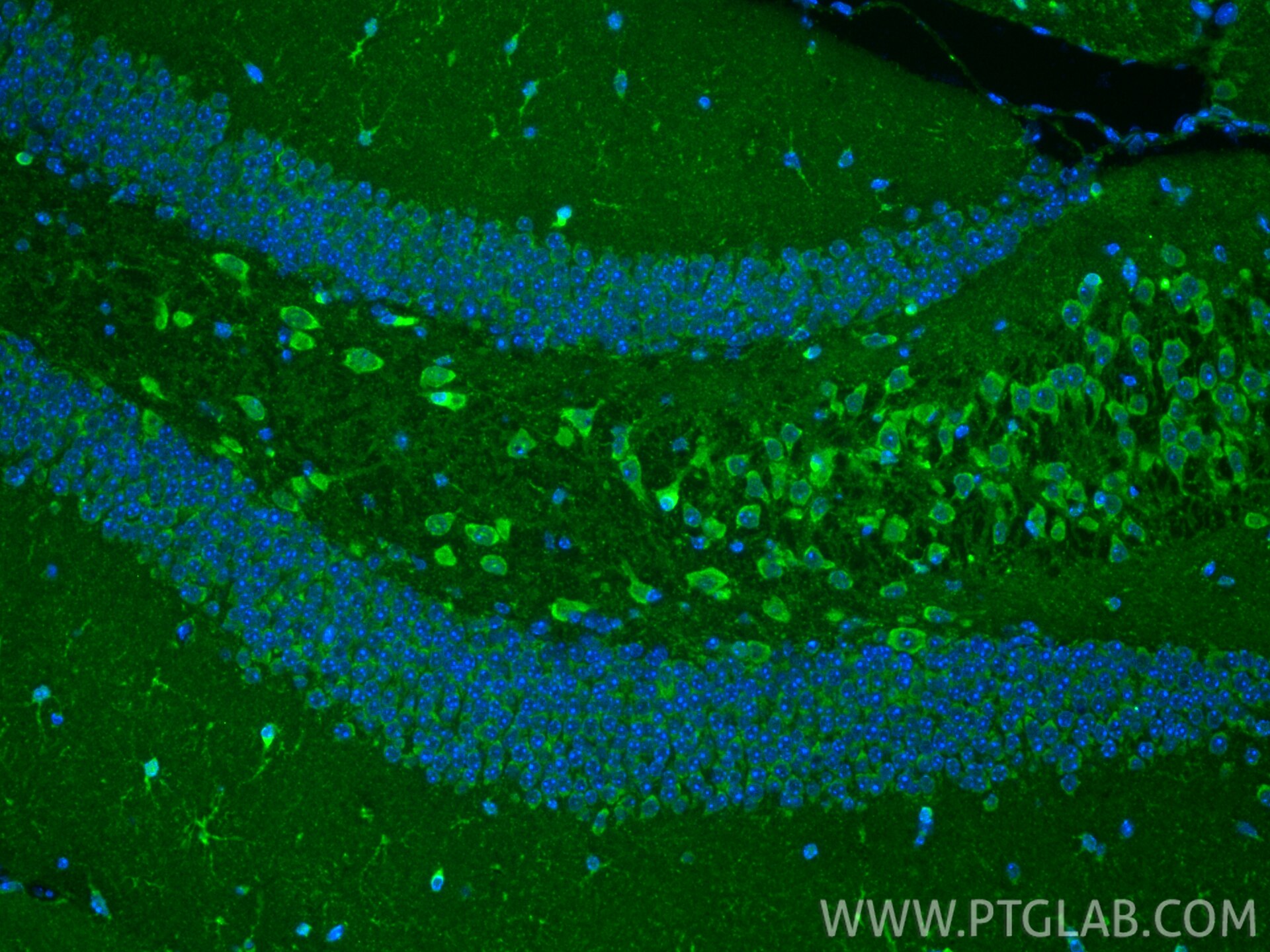 IF Staining of mouse brain using 29354-1-AP Immunofluorescence (IF) / fluorescent staining of mouse brain tissue using AASS Polyclonal antibody (29354-1-AP)