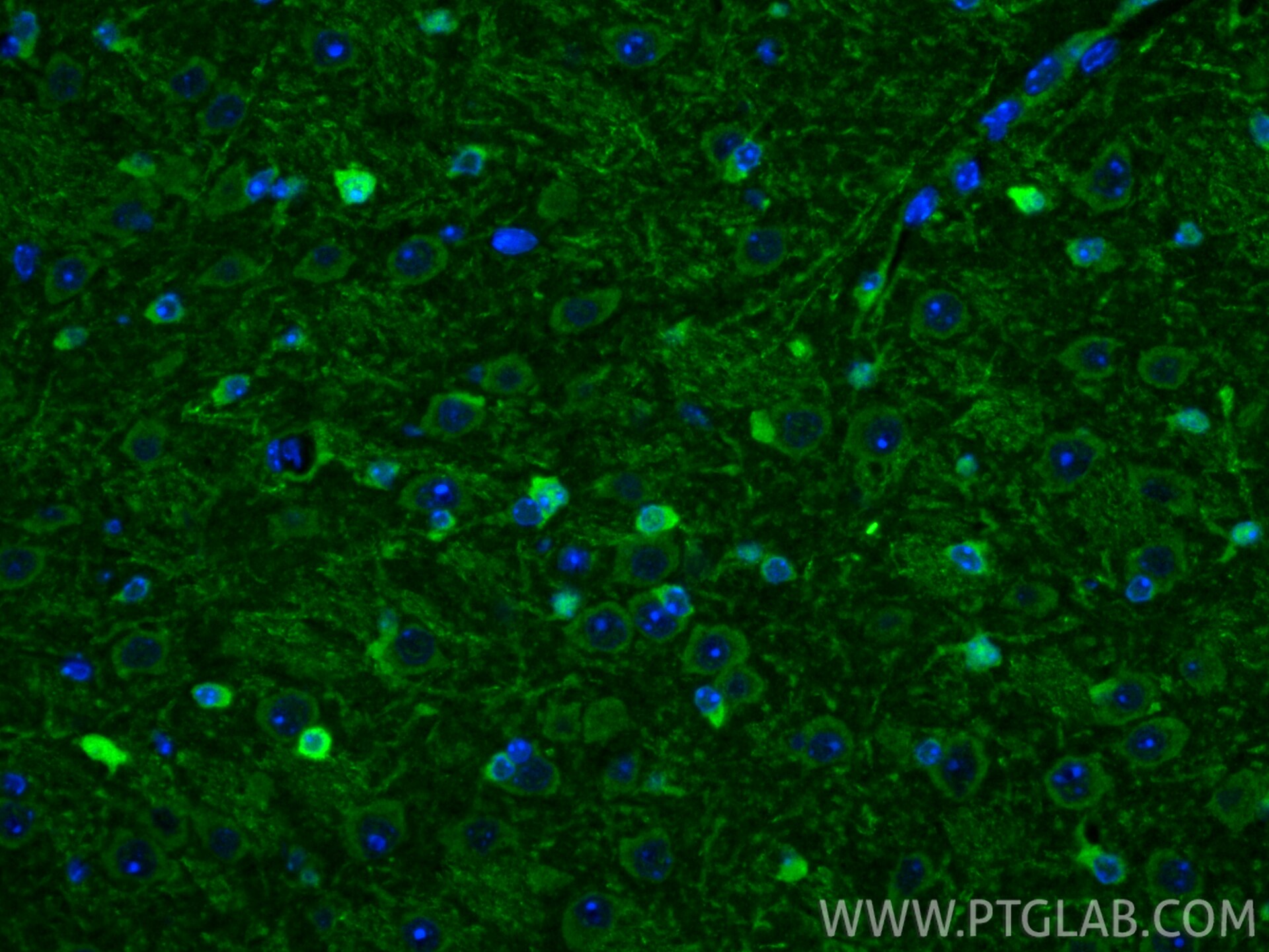 IF Staining of mouse brain using 29354-1-AP Immunofluorescence (IF) / fluorescent staining of mouse brain tissue using AASS Polyclonal antibody (29354-1-AP)