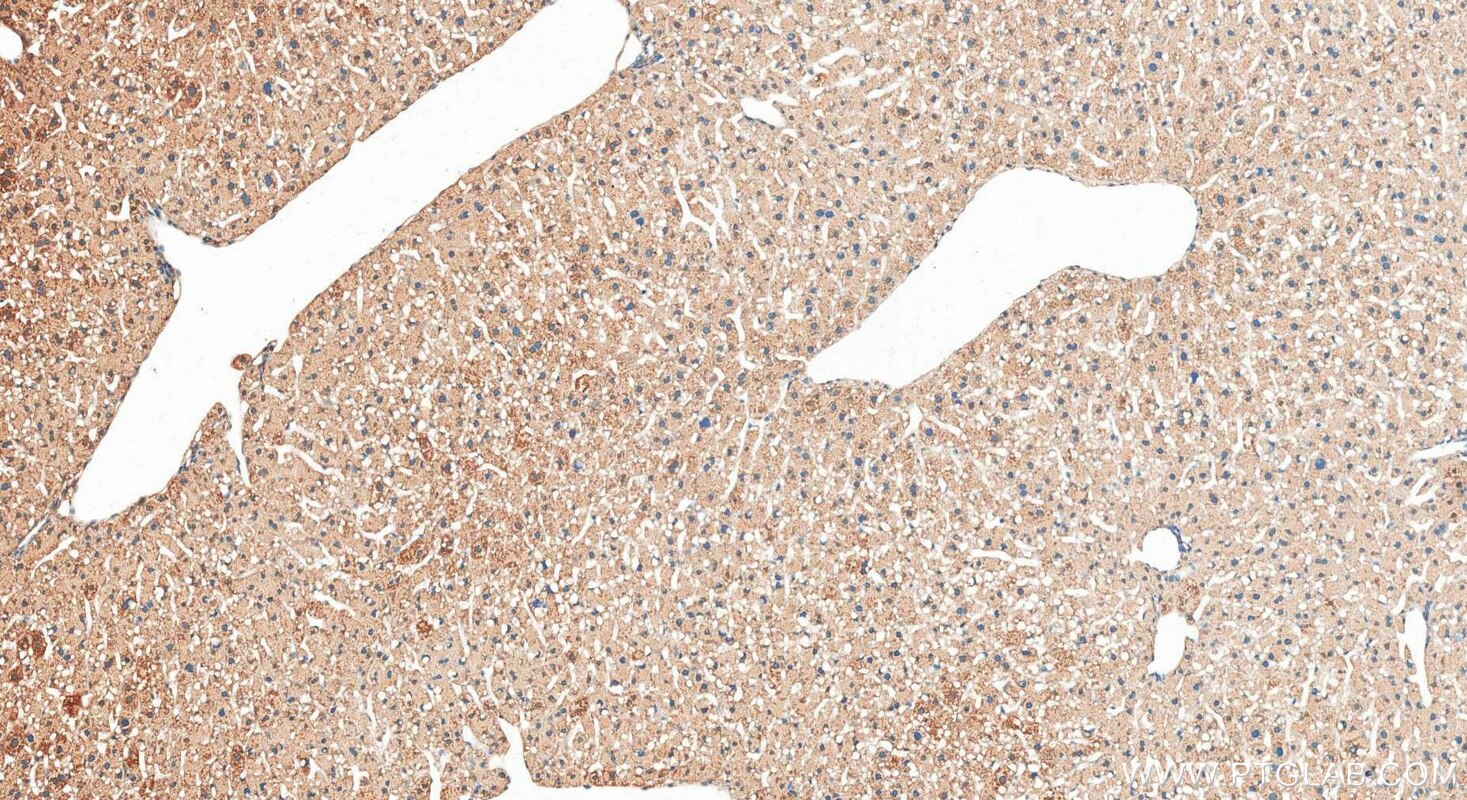 IHC staining of mouse liver using 29354-1-AP Immunohistochemistry (IHC) staining of mouse liver tissue using AASS Polyclonal antibody (29354-1-AP)