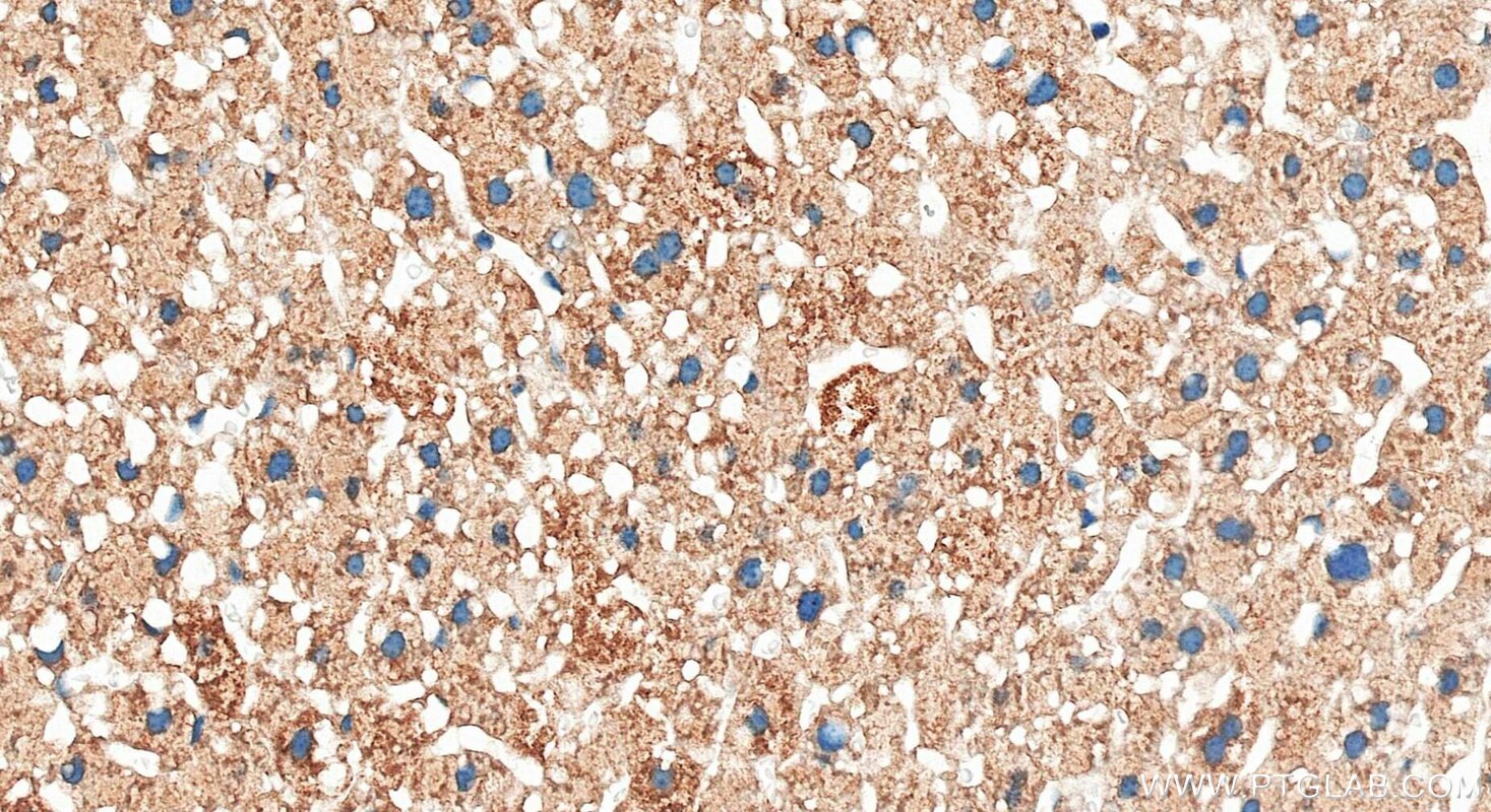 IHC staining of mouse liver using 29354-1-AP Immunohistochemistry (IHC) staining of mouse liver tissue using AASS Polyclonal antibody (29354-1-AP)