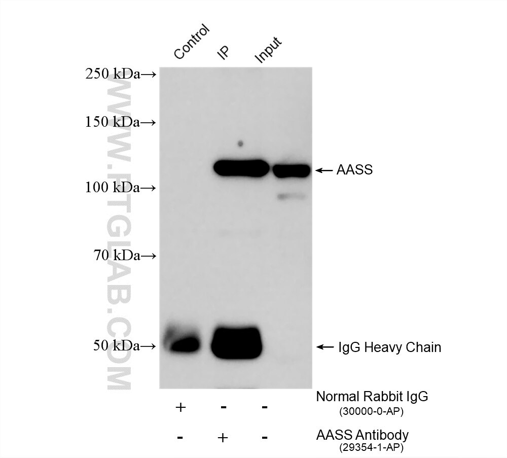 IP experiment of mouse liver using 29354-1-AP Immunoprecipitation (IP) experiment of mouse liver tissue using AASS Polyclonal antibody (29354-1-AP)