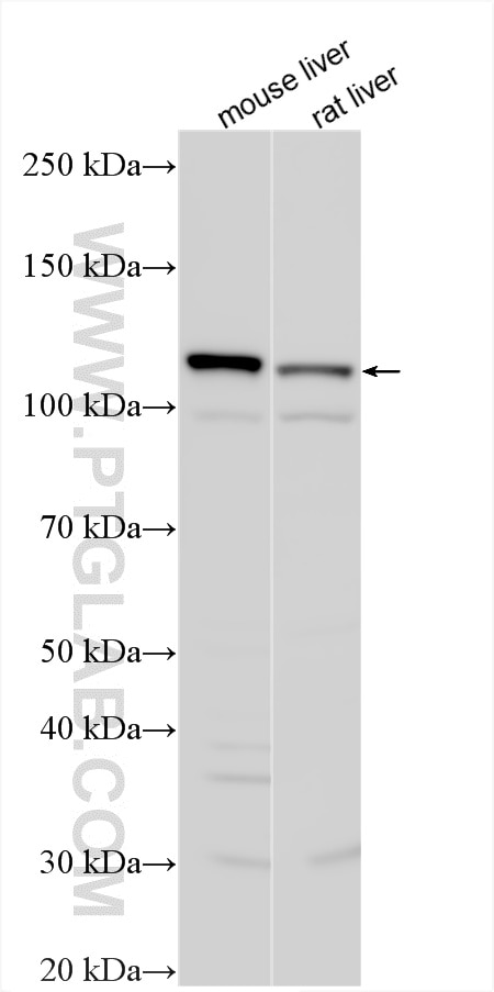 WB analysis using 29354-1-AP Western Blot (WB) analysis of various lysates using AASS Polyclonal antibody (29354-1-AP)