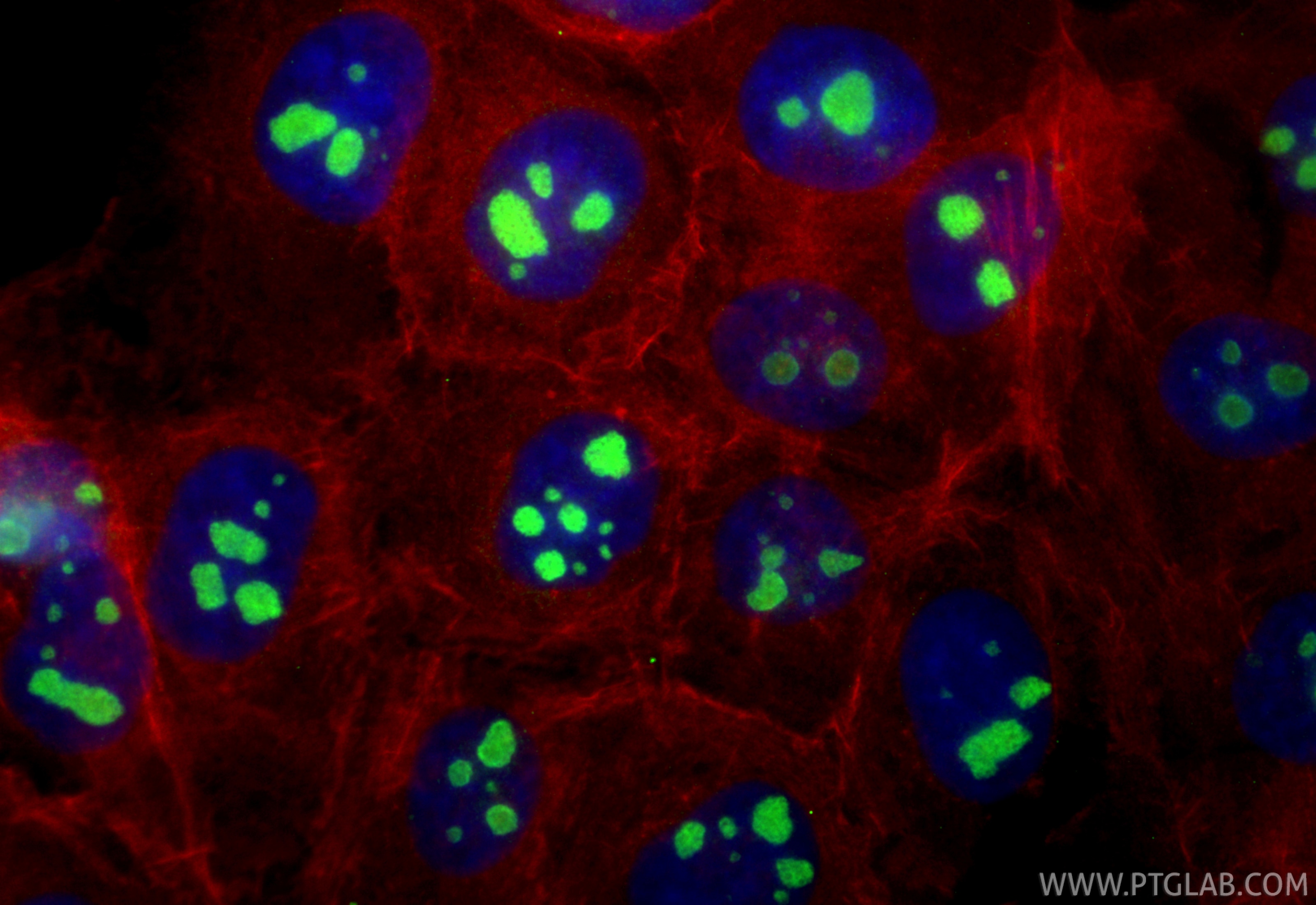 Immunofluorescence (IF) / fluorescent staining of A431 cells using AATF Polyclonal antibody (10282-1-AP)