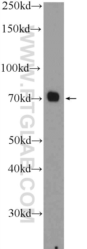 Western Blot (WB) analysis of mouse brain tissue using AATF Polyclonal antibody (10282-1-AP)