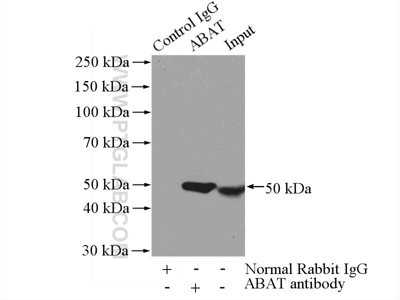 Immunoprecipitation (IP) experiment of mouse liver tissue using ABAT Polyclonal antibody (11349-1-AP)