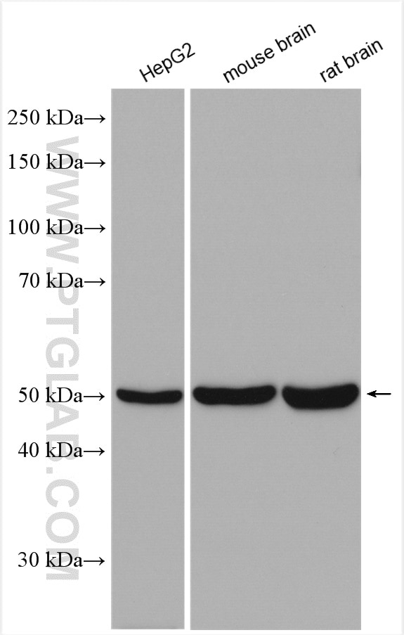 Western Blot (WB) analysis of various lysates using ABAT Polyclonal antibody (11349-1-AP)