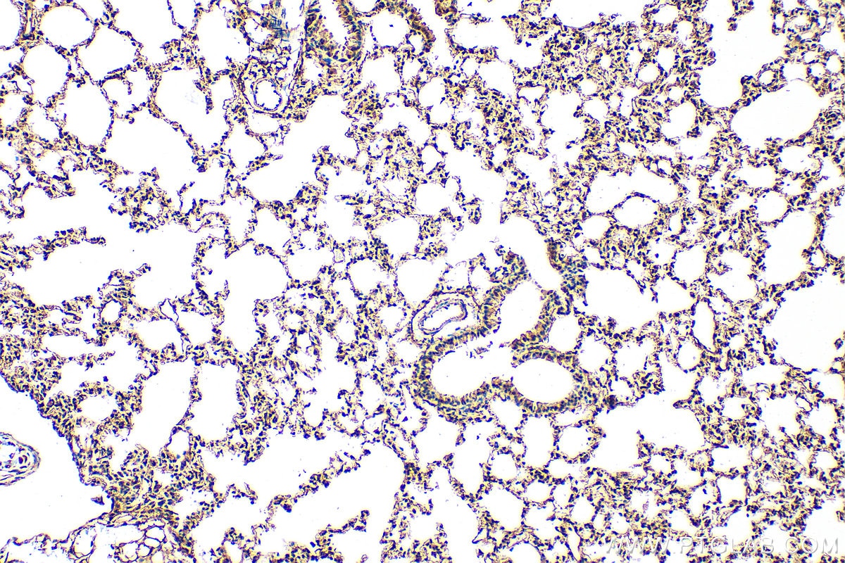 Immunohistochemistry (IHC) staining of mouse lung tissue using ABCA1 Polyclonal antibody (26564-1-AP)