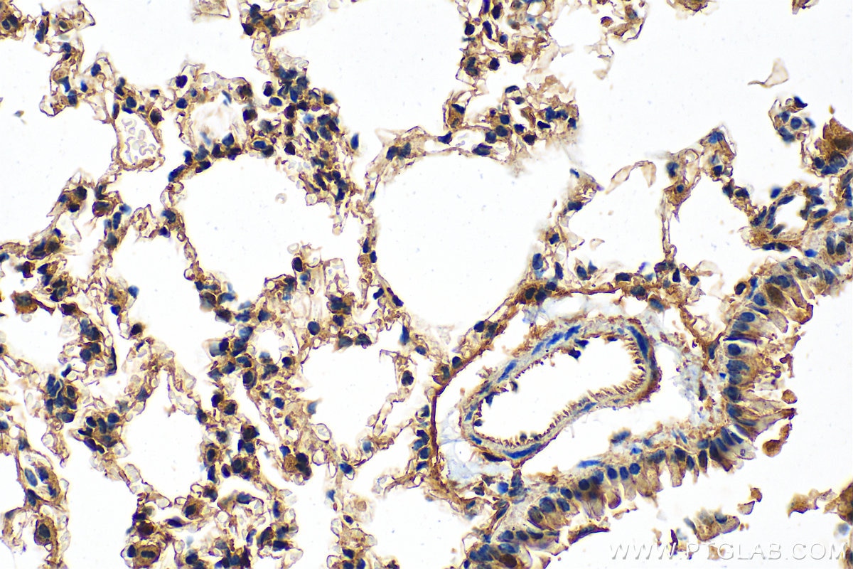 Immunohistochemical analysis of paraffin-embedded mouse lung tissue slide using 26564-1-AP (ABCA1 antibody) at dilution of 1:200 (under 40x lens). Heat mediated antigen retrieval with Tris-EDTA buffer (pH 9.0). Immunohistochemistry (IHC) staining of mouse lung tissue using ABCA1 Polyclonal antibody (26564-1-AP)