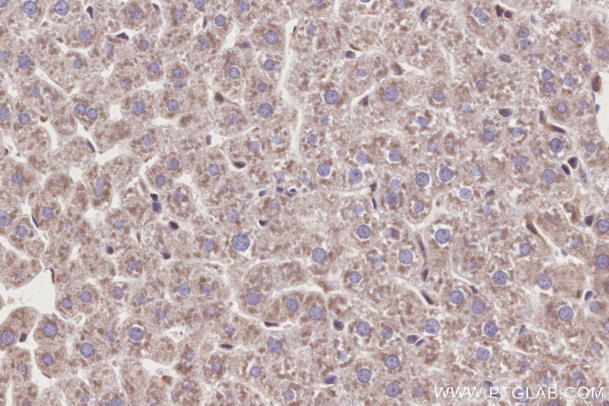 Immunohistochemical analysis of paraffin-embedded rat liver tissue slide using 26564-1-AP (ABCA1 antibody) at dilution of 1:1000 (under 40x lens). Heat mediated antigen retrieval with Tris-EDTA buffer (pH 9.0). Immunohistochemistry (IHC) staining of rat liver tissue using ABCA1 Polyclonal antibody (26564-1-AP)