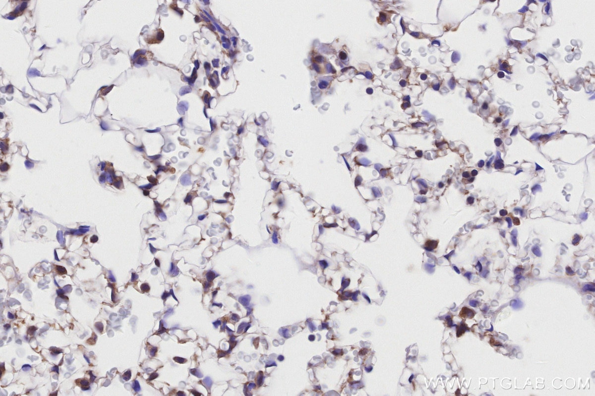 Immunohistochemical analysis of paraffin-embedded rat lung tissue slide using 26564-1-AP (ABCA1 antibody) at dilution of 1:1000 (under 40x lens). Heat mediated antigen retrieval with Tris-EDTA buffer (pH 9.0). Immunohistochemistry (IHC) staining of rat lung tissue using ABCA1 Polyclonal antibody (26564-1-AP)