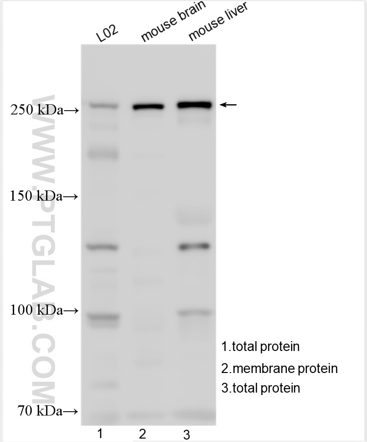 Western Blot (WB) analysis of various lysates using ABCA1 Polyclonal antibody (26564-1-AP)