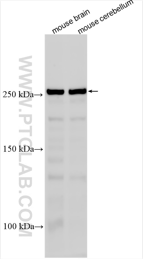 Western Blot (WB) analysis of various lysates using ABCA1 Polyclonal antibody (26564-1-AP)