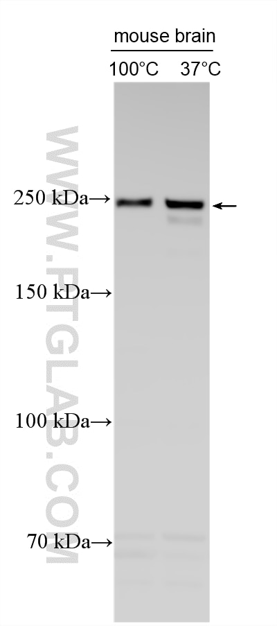 Western Blot (WB) analysis of various lysates using ABCA1 Polyclonal antibody (26564-1-AP)