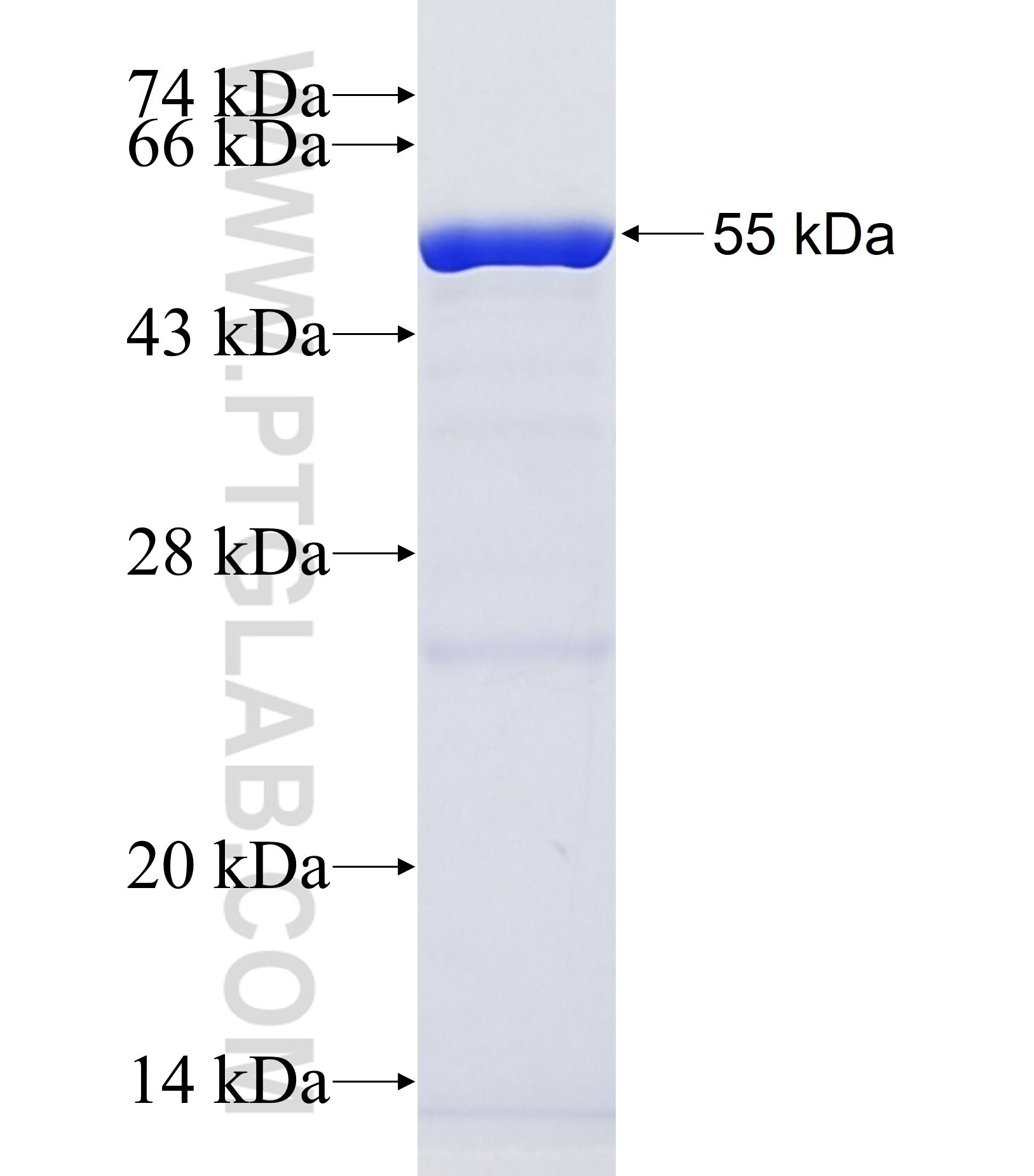 ABCA1 fusion protein Ag37398 SDS-PAGE ABCA1 fusion protein Ag37398 SDS-PAGE