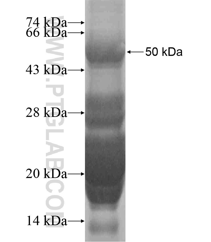 ABCA11P fusion protein Ag18458 SDS-PAGE