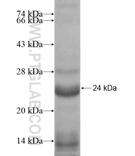 ABCA11P fusion protein Ag19276 SDS-PAGE