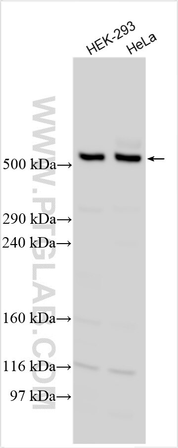 Western Blot (WB) analysis of various lysates using ABCA13 Polyclonal antibody (19764-1-AP)