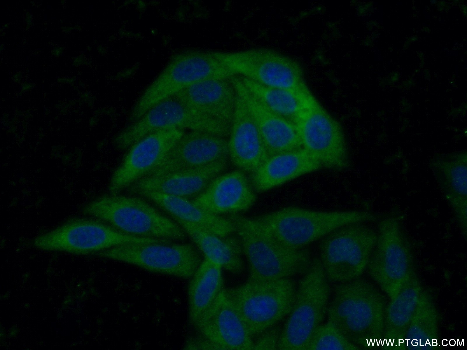 Immunofluorescence (IF) / fluorescent staining of HepG2 cells using ABCA2 Polyclonal antibody (20681-1-AP)