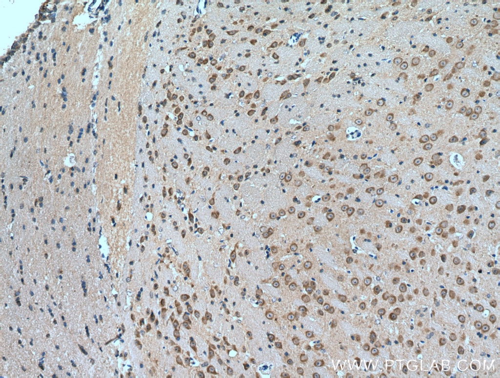 Immunohistochemistry (IHC) staining of mouse brain tissue using ABCA2 Polyclonal antibody (20681-1-AP)