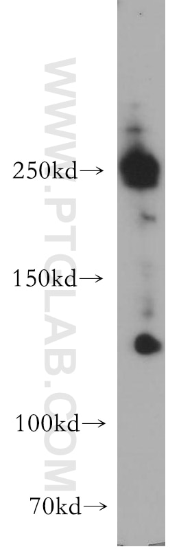 Western Blot (WB) analysis of HepG2 cells using ABCA2 Polyclonal antibody (20681-1-AP)